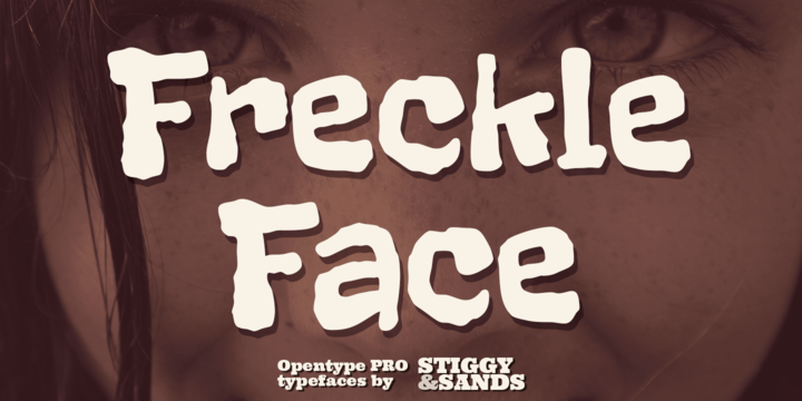Freckle Face